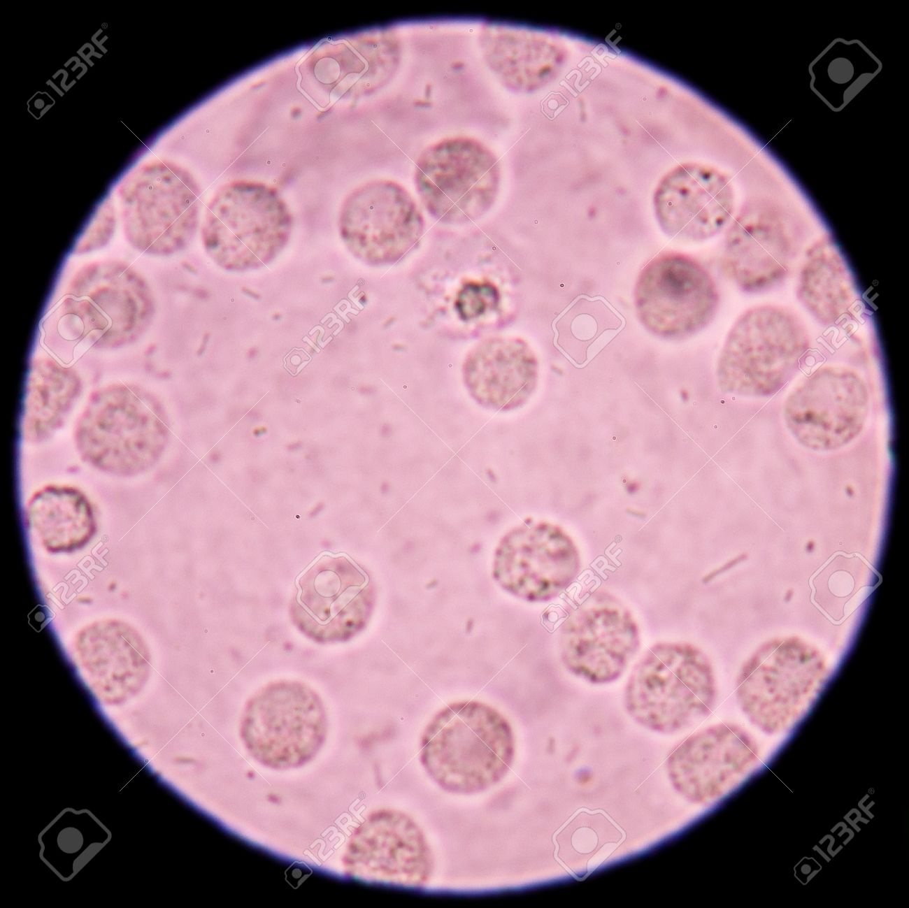 細菌や白血球尿顕微鏡 400 倍下で標本にします の写真素材 画像素材 Image
