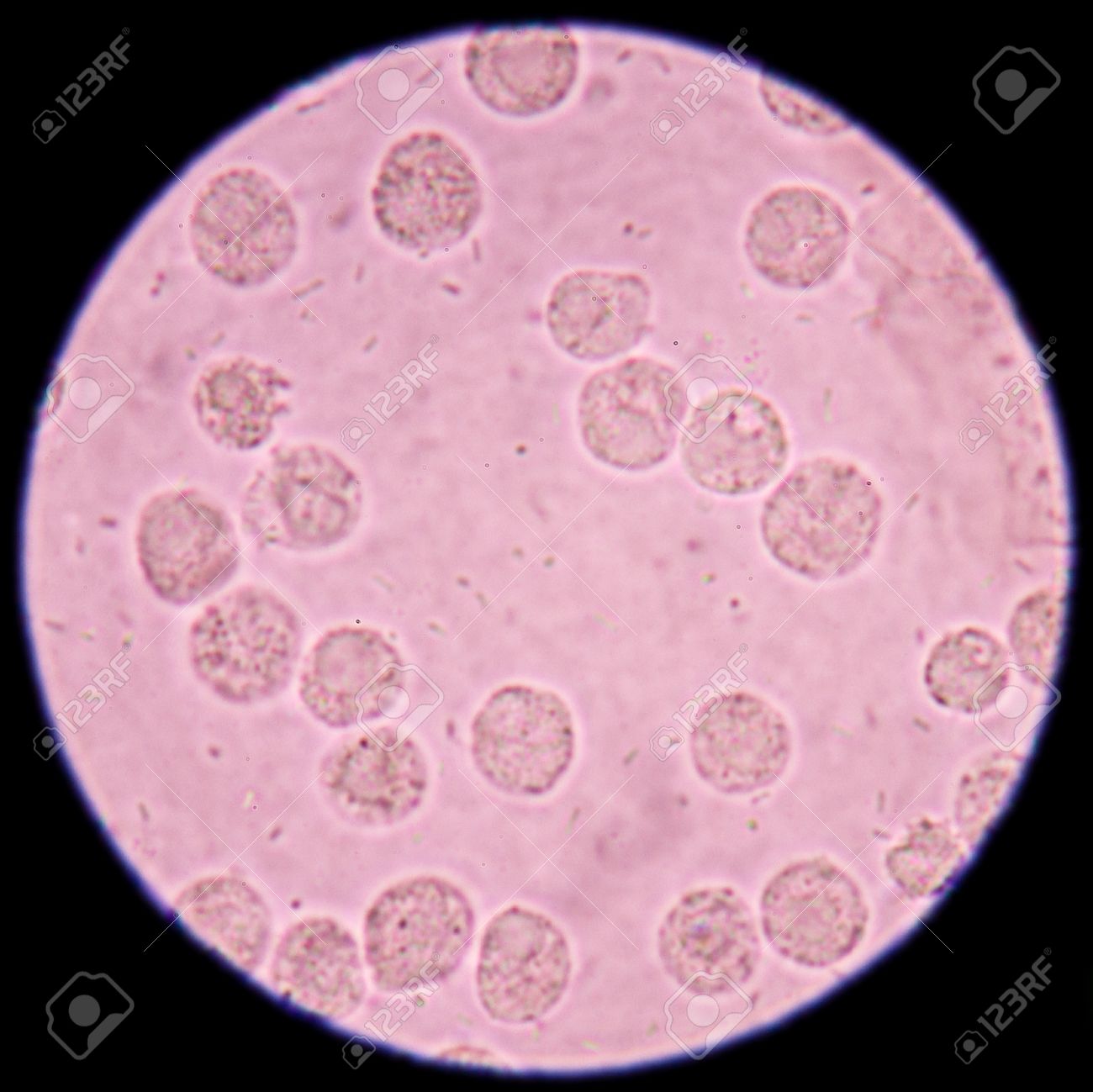 細菌や白血球尿顕微鏡 400 倍下で標本にします の写真素材 画像素材 Image