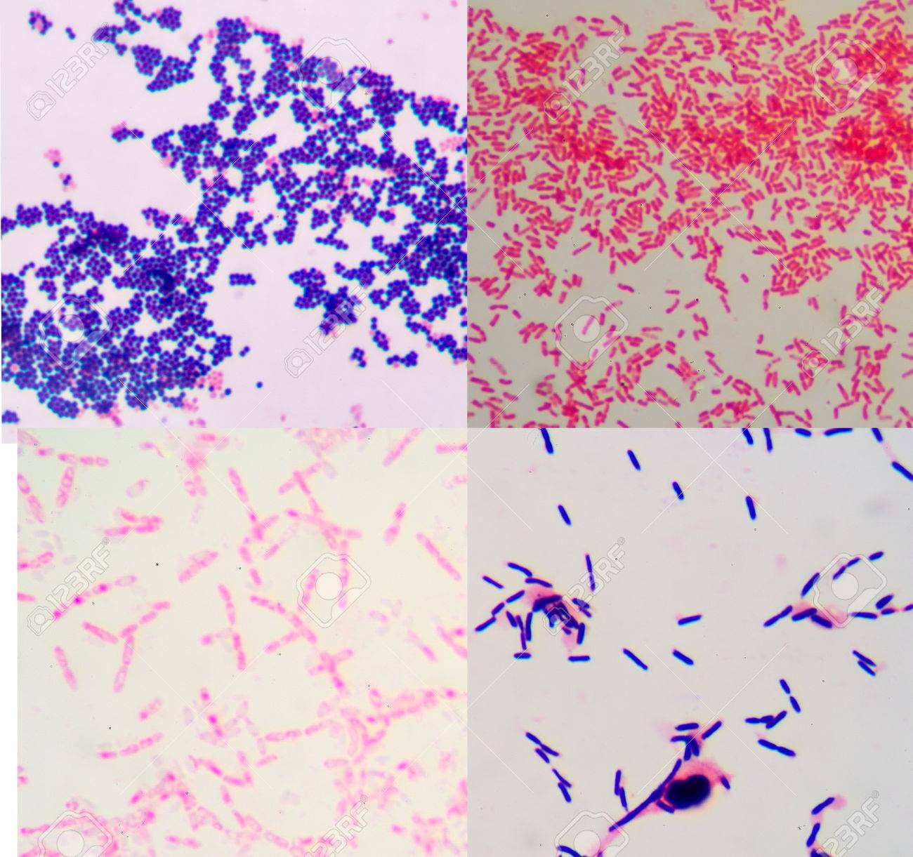 グラム陽性およびグラム陰性の 2 つの大きなグループに菌種を鑑別する方法は グラム染色 グラムのメソッドとも呼ばれます の写真素材 画像素材 Image