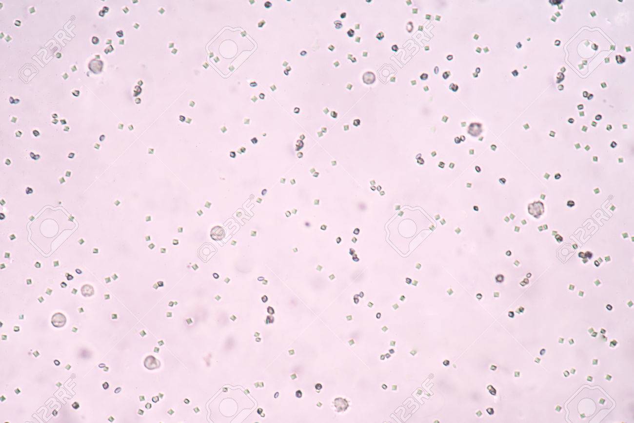 Modere Cristaux D Oxalate De Calcium Dans L Analyse D Urine Banque D Images Et Photos Libres De Droits Image 47187736