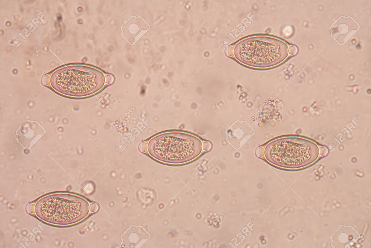 A trichocephalosis geohelminth Hogyan fertőződnek a Trichinella