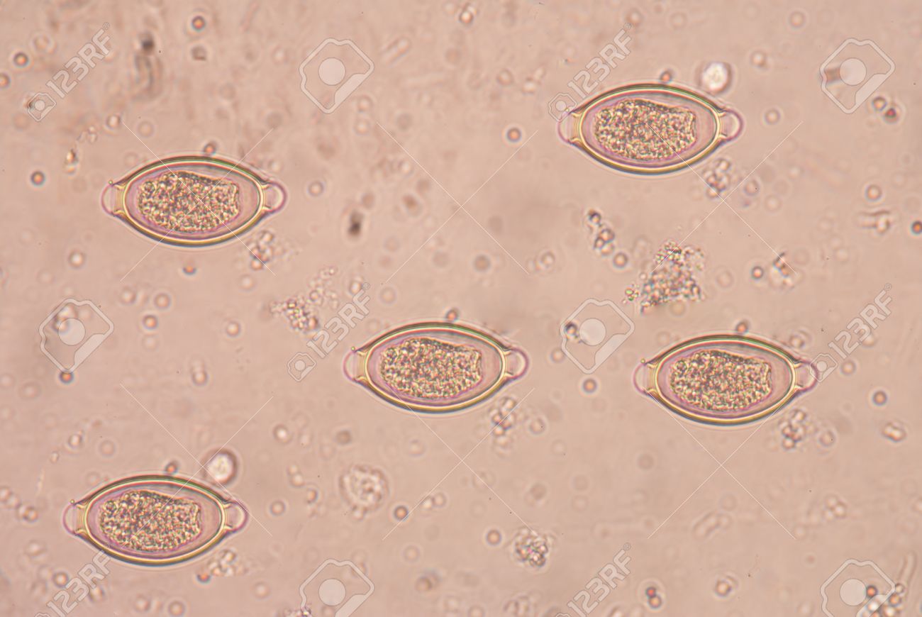 A trichocephalosis geohelminth