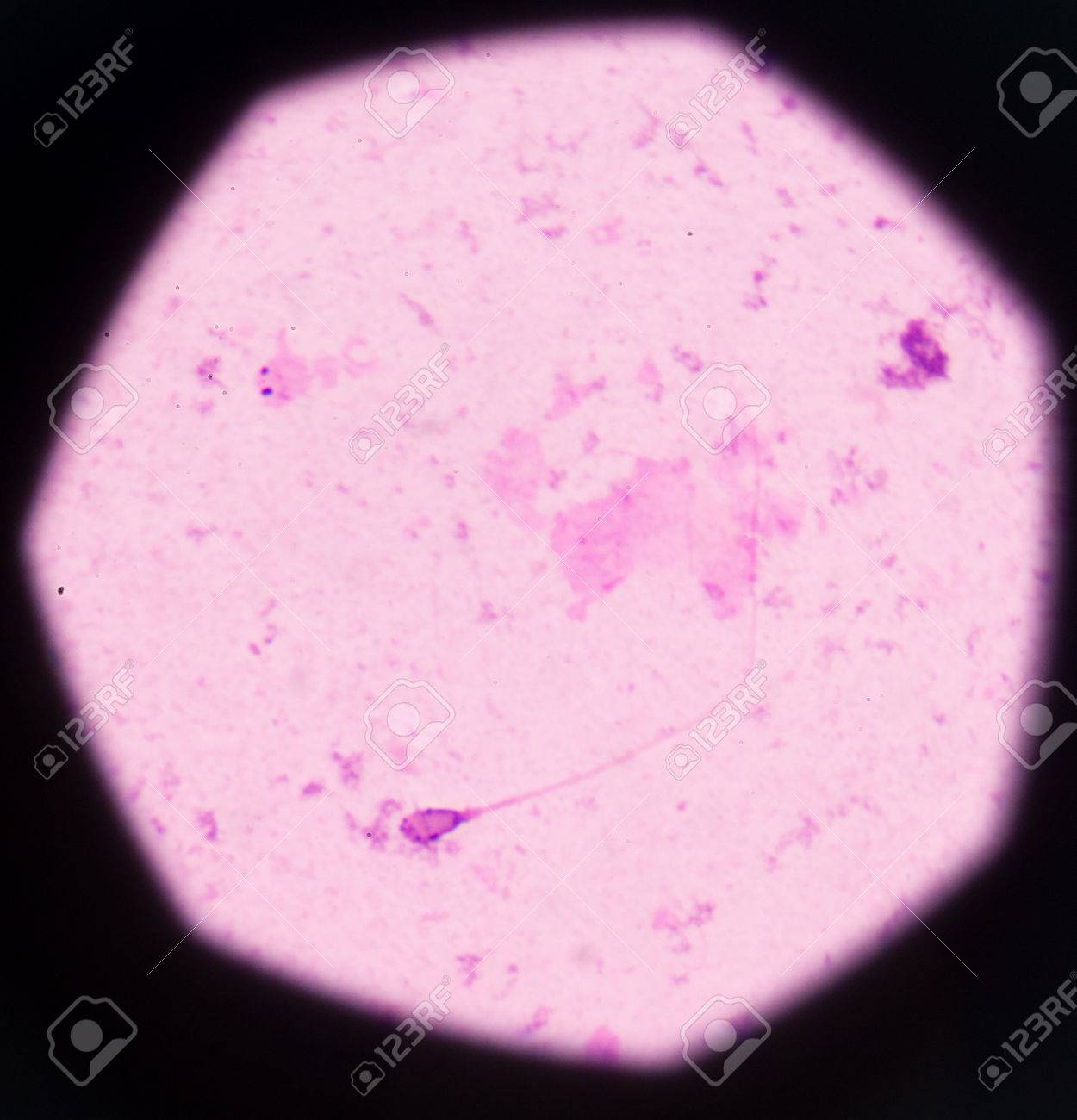 人間の精子は研究室で顕微鏡を用いた細かい の写真素材 画像素材 Image