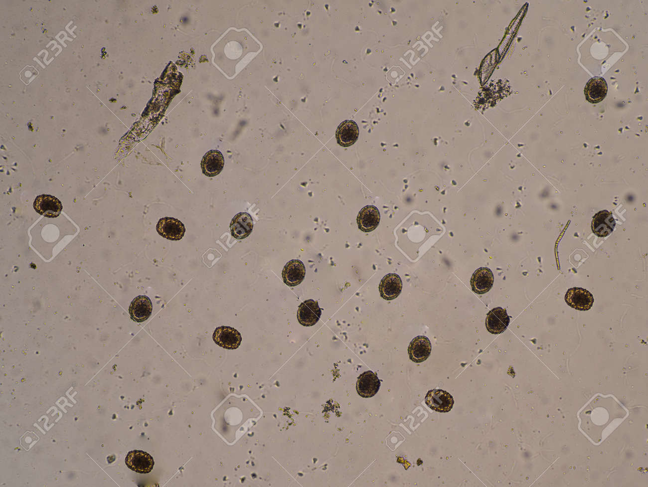 Moderate Ascaris Lumbricoides Egg In Stool Examination. Фотография,  картинки, изображения и сток-фотография без роялти. Image 166607074