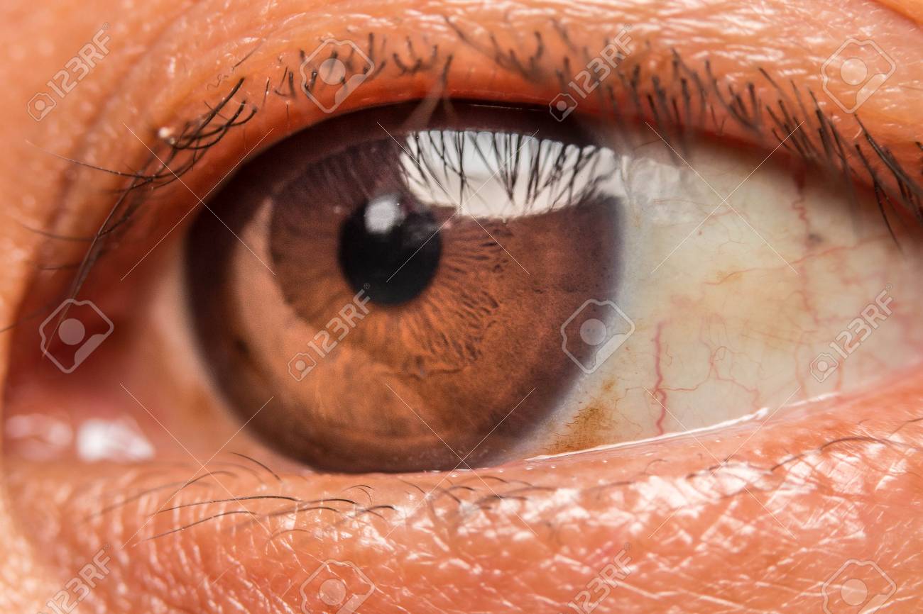 Macro Photo Of The Eye Blood Vessels On The Eyes Eyelashes