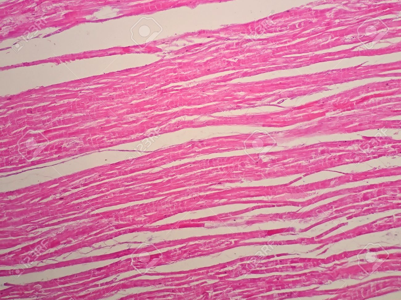 pic Cardiac Muscle Under Microscope 40X histology of cardiac muscle under microscope view