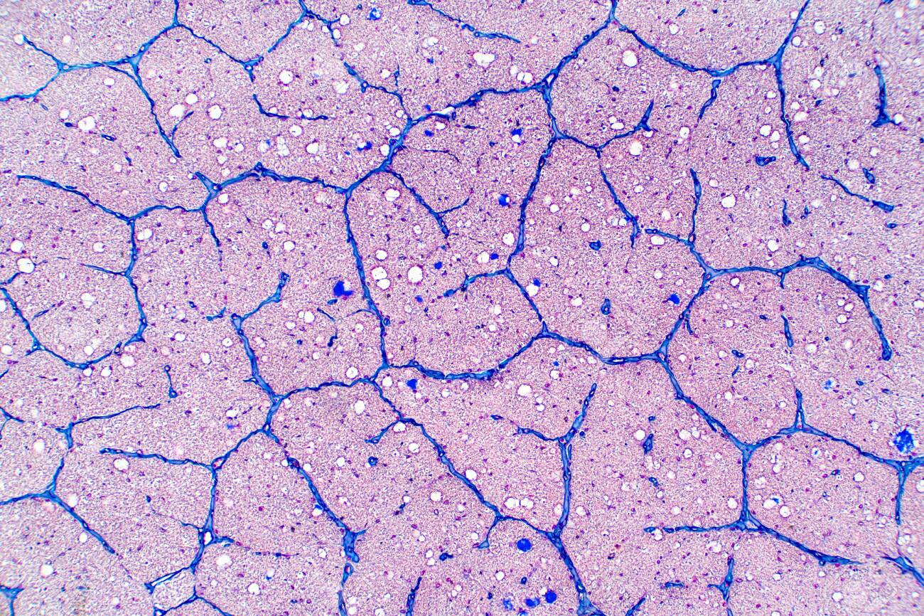 Human eye nerve under the microscope view. Histological for human physiology. - 120853809 Human eye nerve under the microscope view. Histological for human physiology. - 120853809