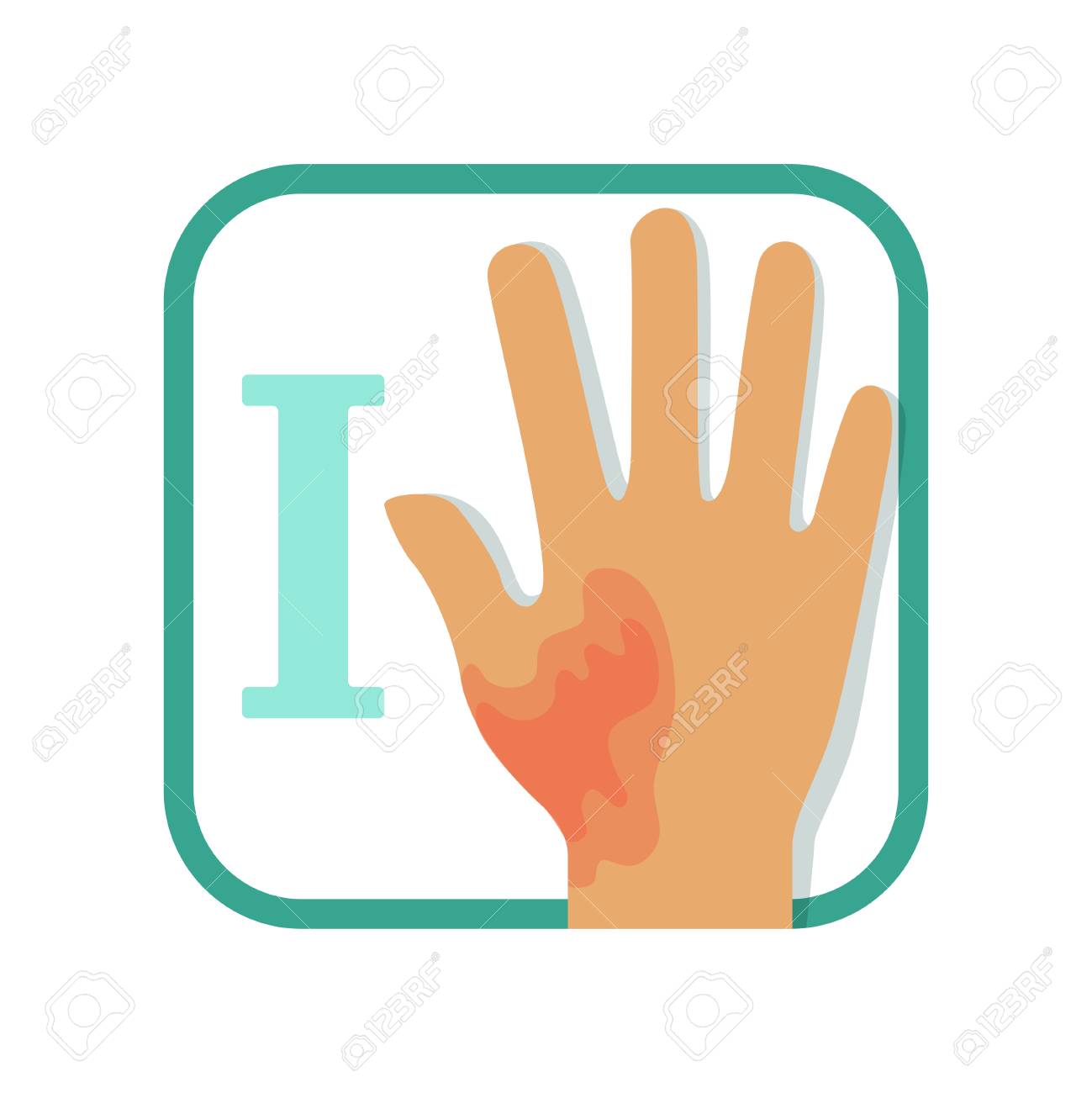 第一度の火傷の有益なイラスト 赤みのある手の損傷 水疱なし 傷害の概念 インフォグラフィックカード パンフレット ポスター用フラットベクトルデザイン の イラスト素材 ベクタ Image 第一度の火傷の有益なイラスト 赤みのある手の損傷 水疱なし 傷害の概念 インフォグラフィックカード パンフレット ポスター用フラットベクトルデザイン の イラスト素材 ベクタ Image