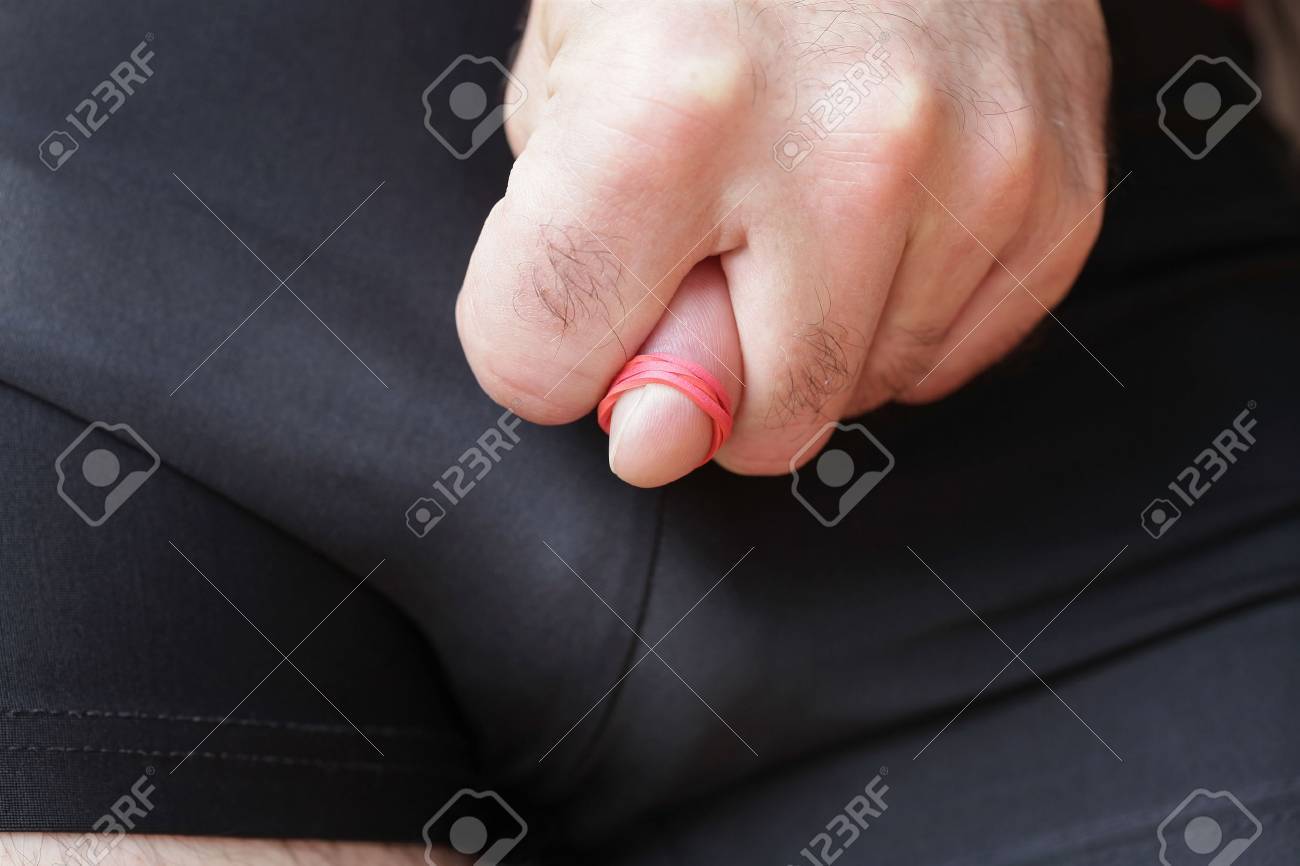 foreskin retracted 包皮を亀頭に撤回を防ぐことの異常な圧迫感/包茎テーマ解釈 Bの写真素材・画像素材 Image 86790243