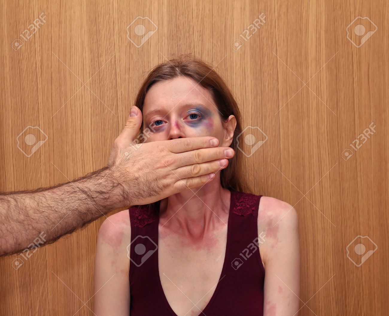 彼女の顔と彼女の口を覆っている男性の手にあざを持つ女性に殴られて の写真素材 画像素材 Image 彼女の顔と彼女の口を覆っている男性の手にあざを持つ女性に殴られて の写真素材 画像素材 Image
