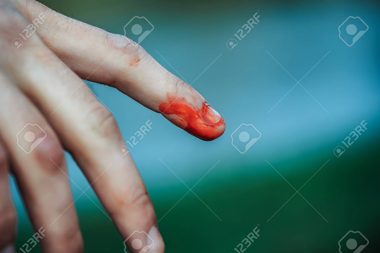 index finger on human hand or palm is cut hurt and bleeding with