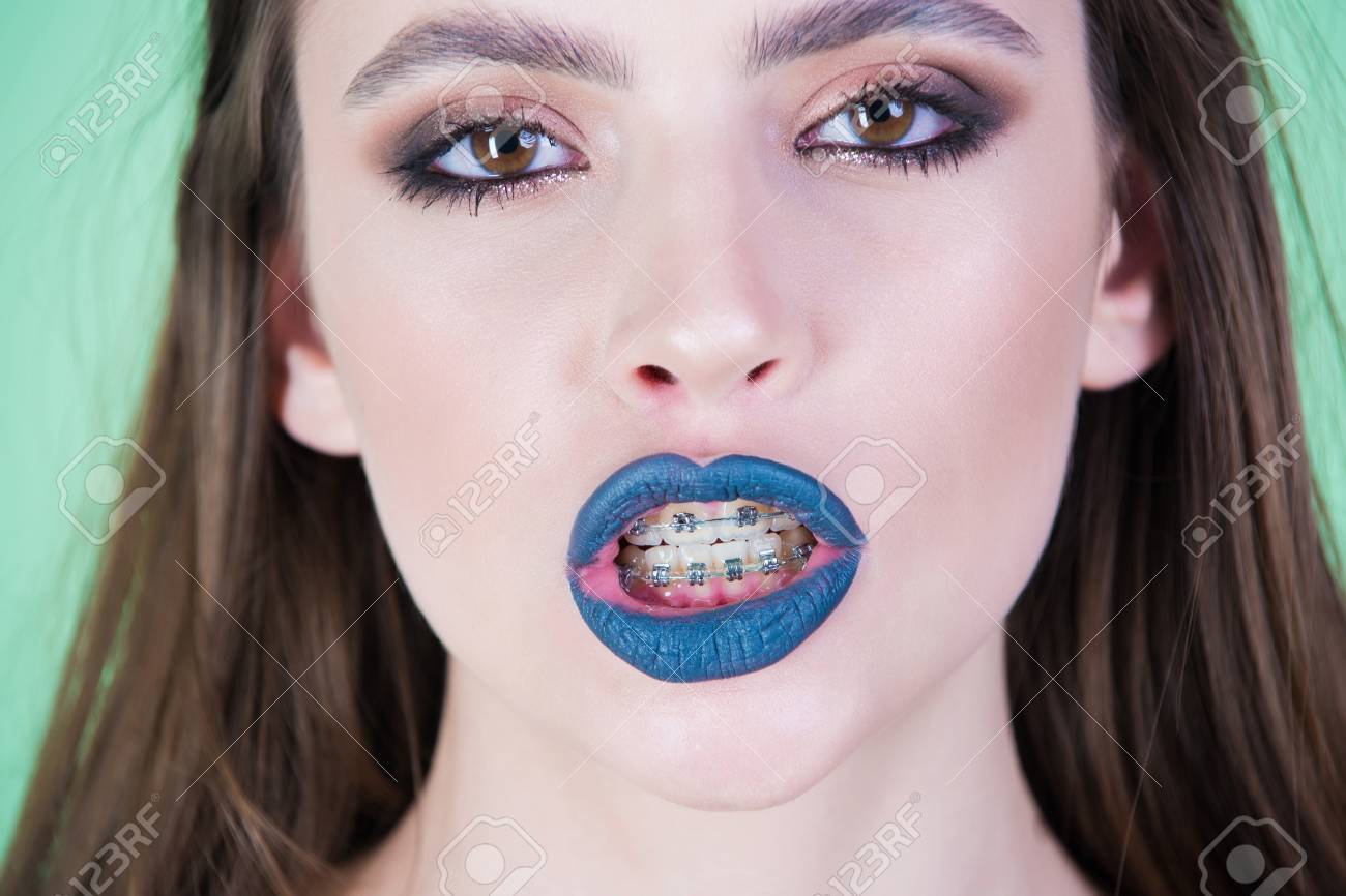 Cute Girl Braces For Teeth Cute Girl Braces For Teeth