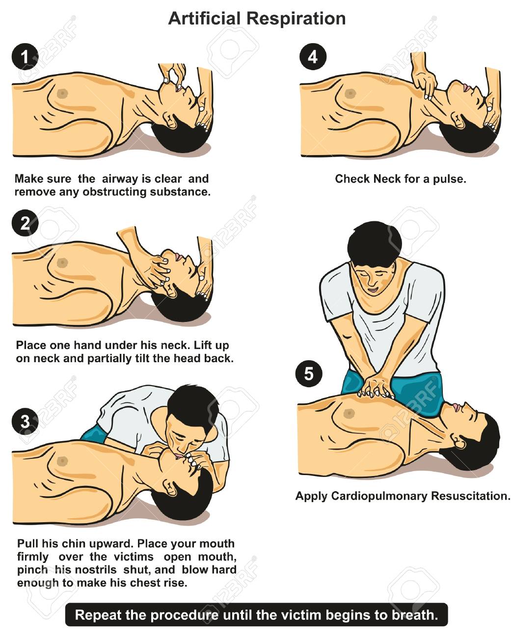 Artificial Respiration infographic diagram step by step poster with instructions showing a first aider providing it to a victim for emergency first aid medical education and health care - 87963294 Artificial Respiration infographic diagram step by step poster with instructions showing a first aider providing it to a victim for emergency first aid medical education and health care - 87963294