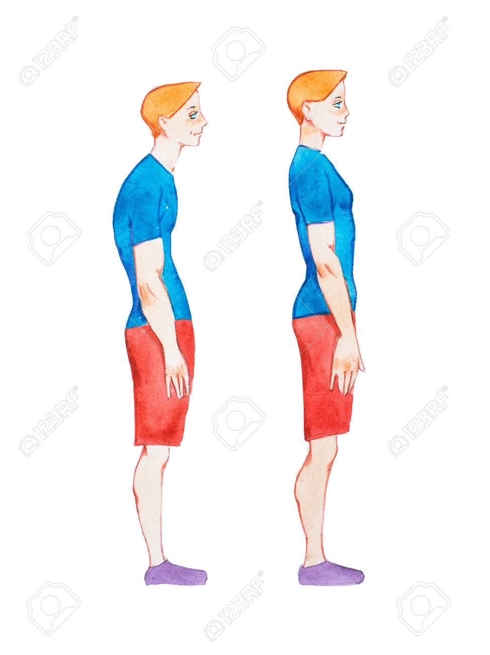 Watercolor illustration of people with right and wrong posture. Man with normal healthy spine and abnormal sick spine in comparison - 80550973 Watercolor illustration of people with right and wrong posture. Man with normal healthy spine and abnormal sick spine in comparison - 80550973