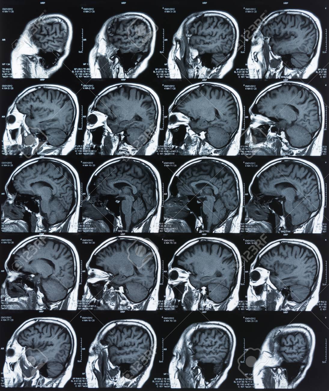 Ct Scan X Rays Ct Scan Machine Ct Scan X Rays Ct Scan Machine