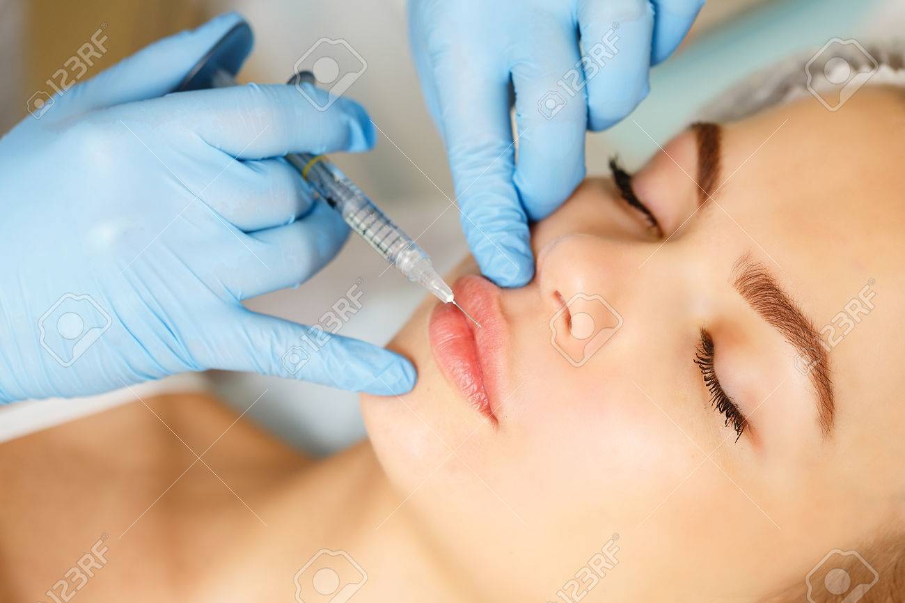 injections of the lips correction form the upper lip injection form beauty