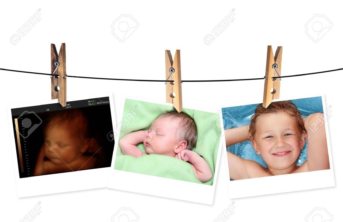 L Image Du Nouveau Ne Comme L Echographie 3d Et Meme Bebe 7 Jours Et 10 Ans Banque D Images Et Photos Libres De Droits Image