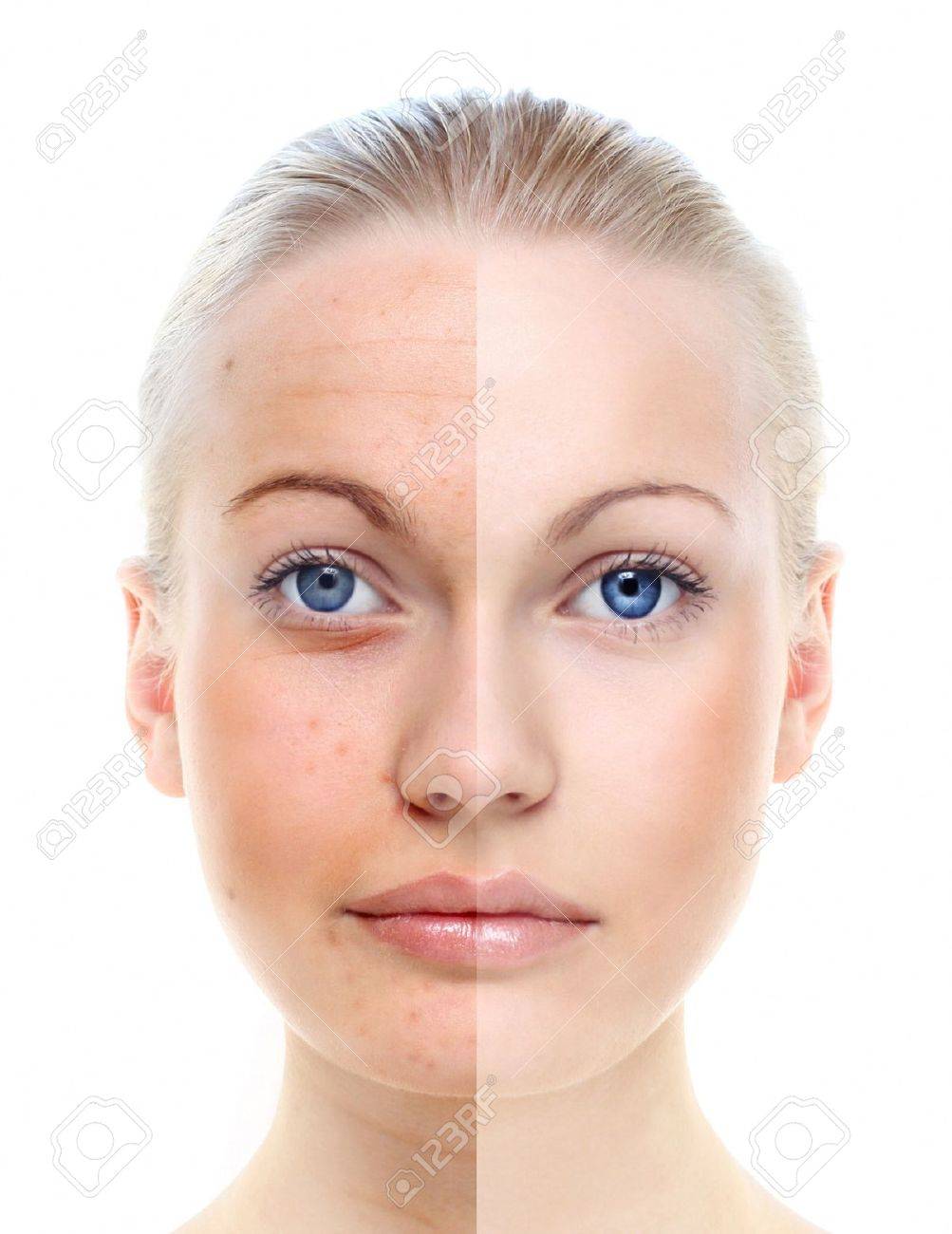 How to Care for the Skin After Laser Hair Removal How to Care for the Skin After Laser Hair Removal new pics How to Care for the Skin After Laser Hair Removal How to Care for the Skin After Laser Hair Removal new foto