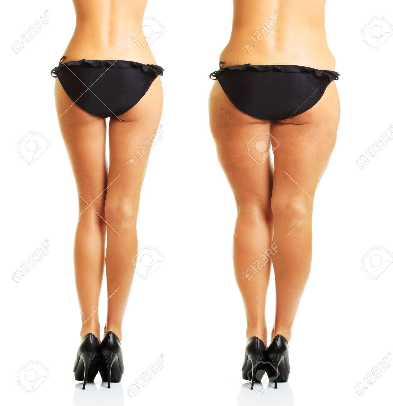 Fat Cellulite Butts Fat Cellulite Butts