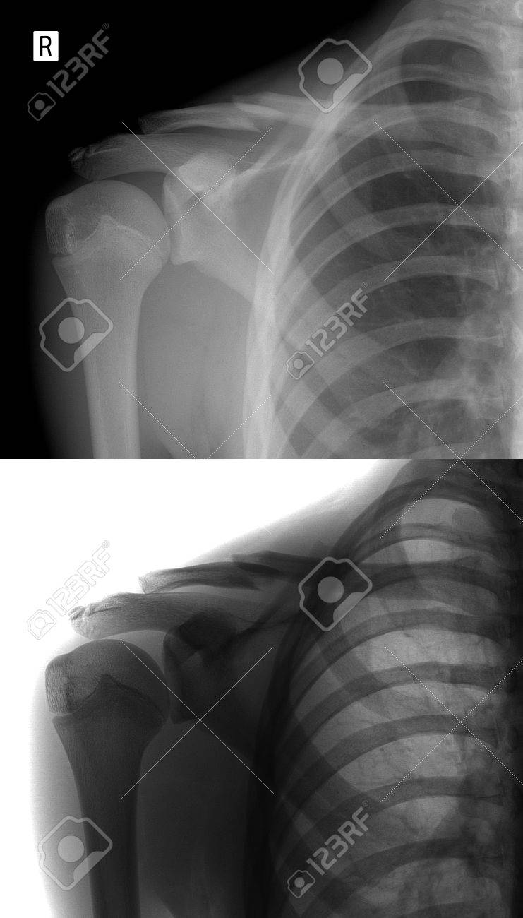 JMSR, image size:741x1300