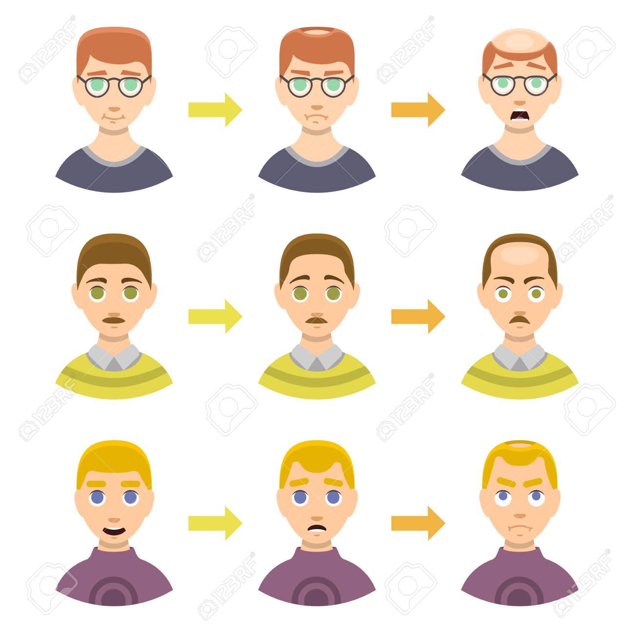 Information Chart Of Hair Loss Stages Types Of Baldness