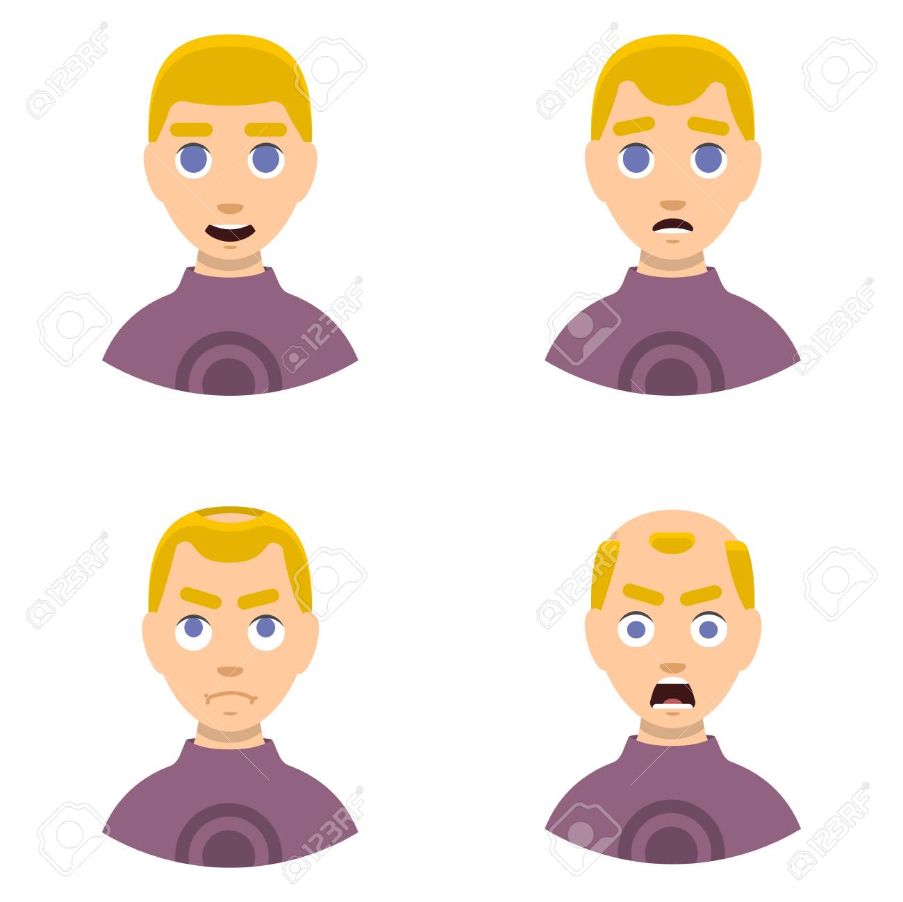 Information Chart Of Hair Loss Stages Types Of Baldness