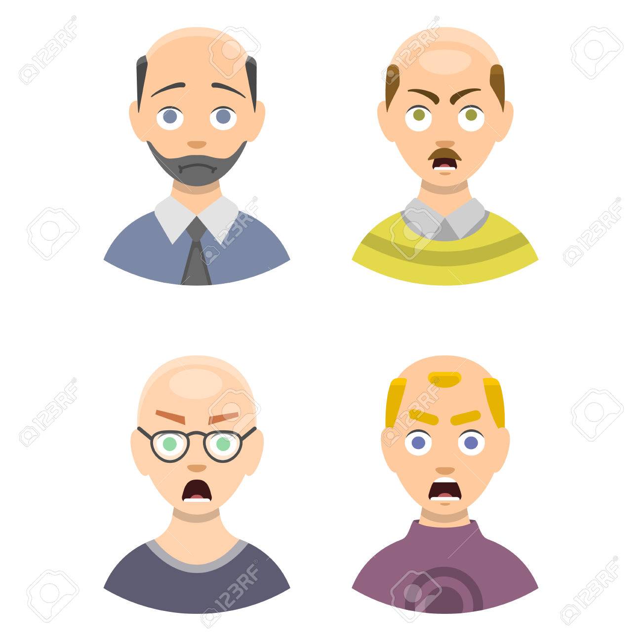 Information Chart Of Hair Loss Stages And Types Of Baldness