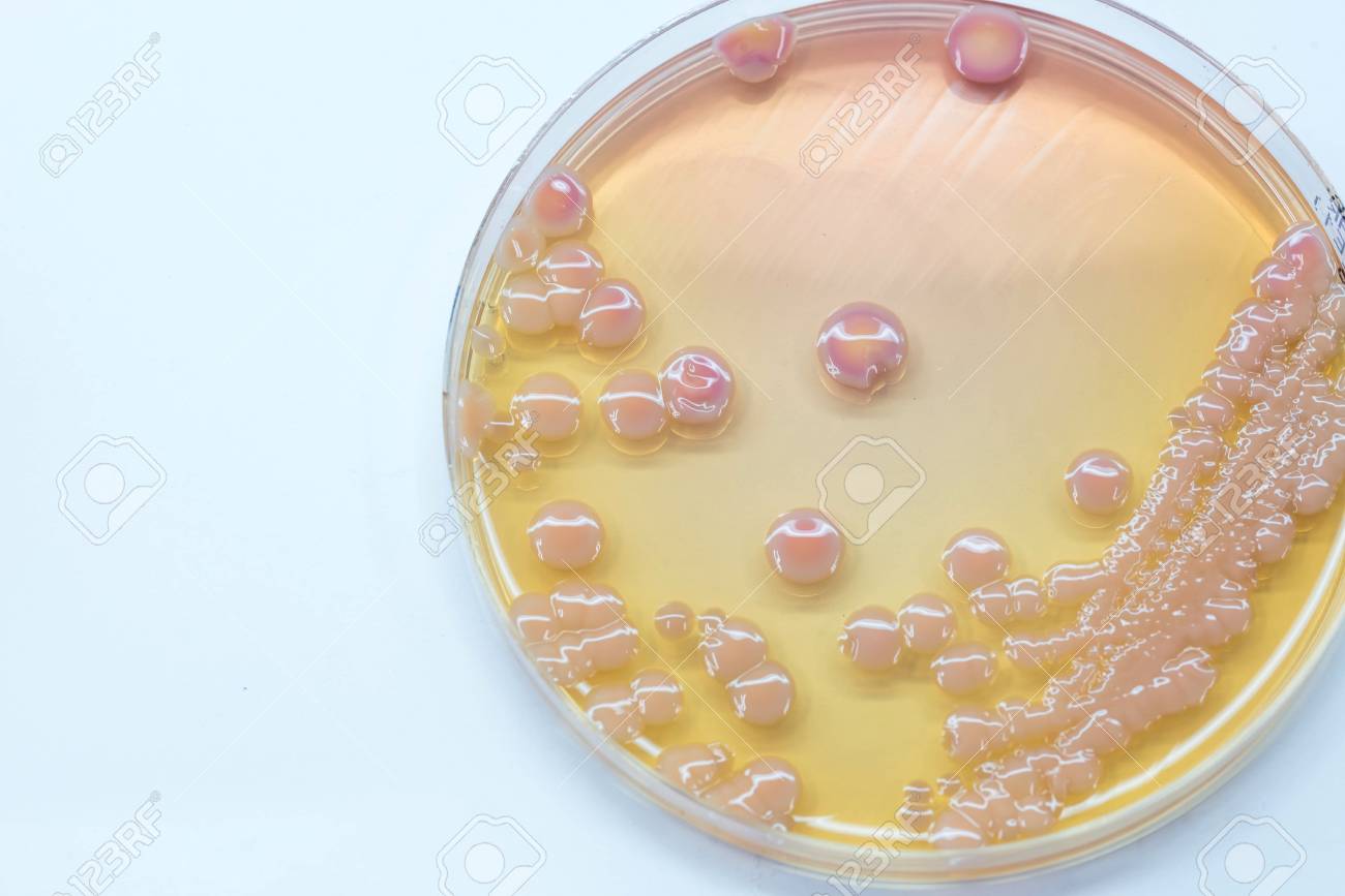klebsiella pneumoniae colonies gram negative bacilli colonies klebsiella pneumoniae gram stain