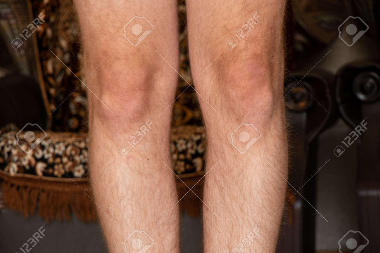 Mens Legs Are Hairy And Kneecap At Home,part Of The Body ,leg Of A Young  Stock Photo, Picture and Royalty Free Image. Image 189905112.