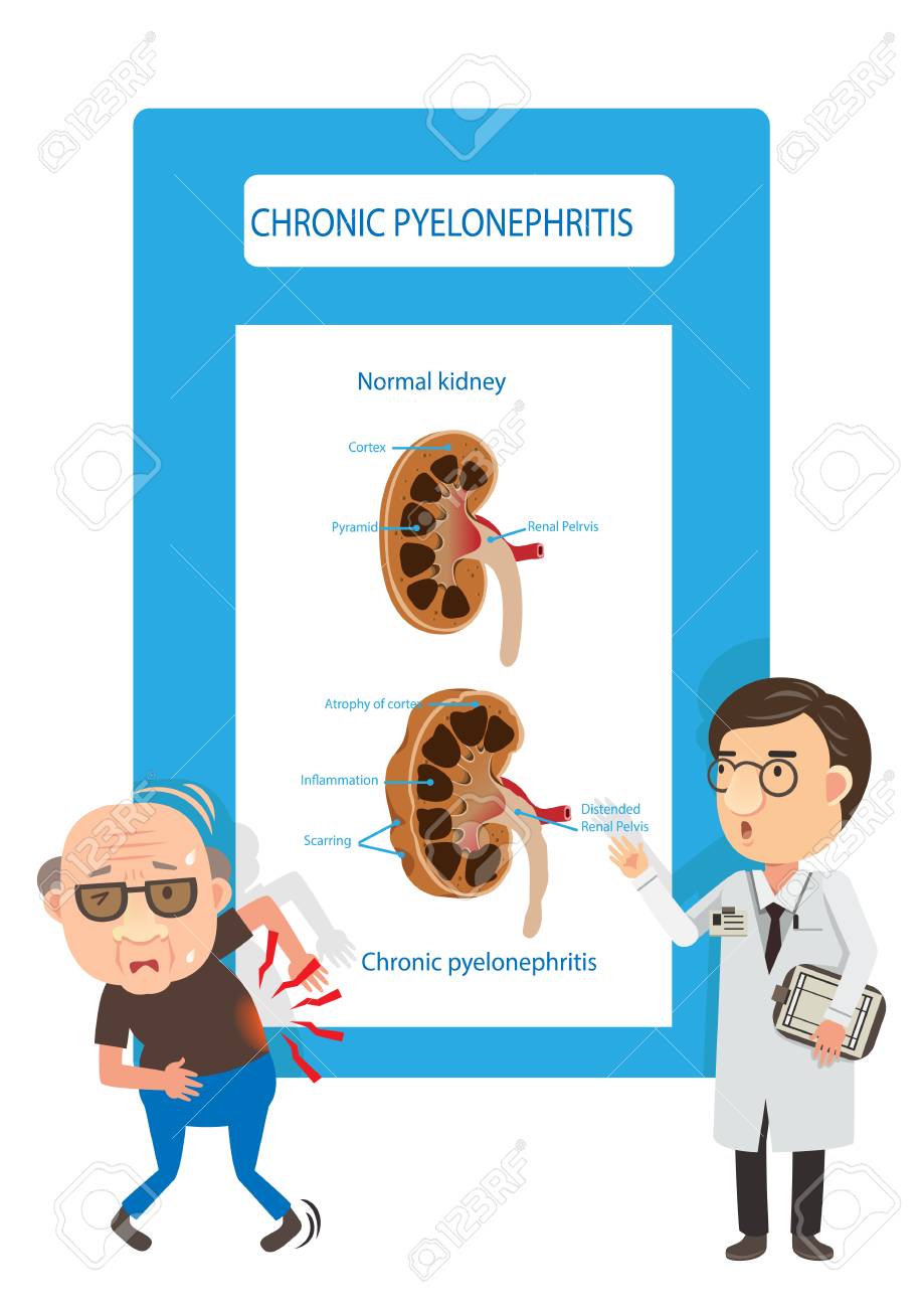 Patients And Doctors Viewing Diagrams Kidney Failure. Vector Illustration.  Royalty Free SVG, Cliparts, Vectors, and Stock Illustration. Image 91367344., image size:919x1300