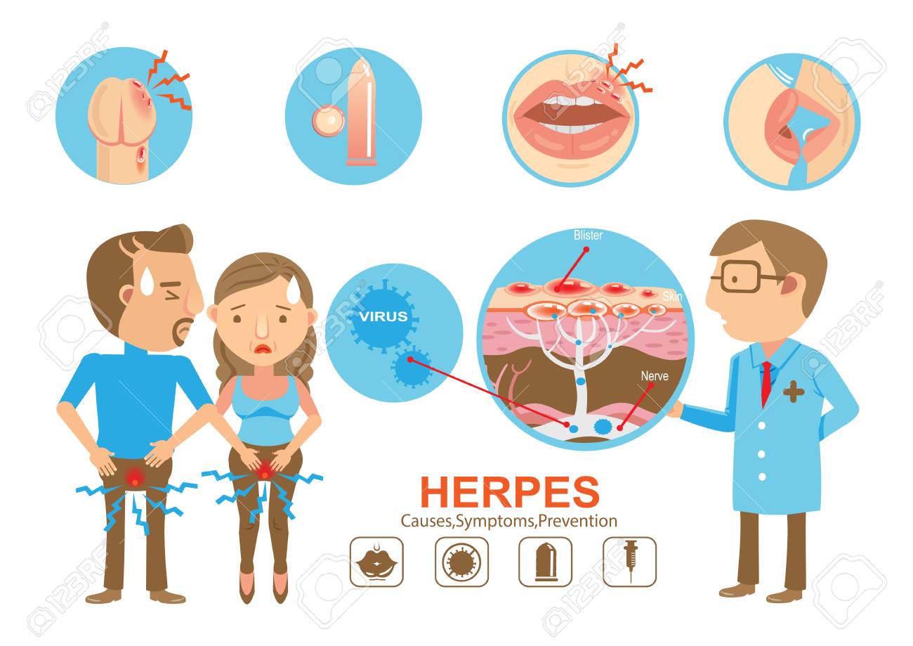 Doctor holding diagram, herpes on the lips and of the young woman and young men. - 91954933 Doctor holding diagram, herpes on the lips and of the young woman and young men. - 91954933