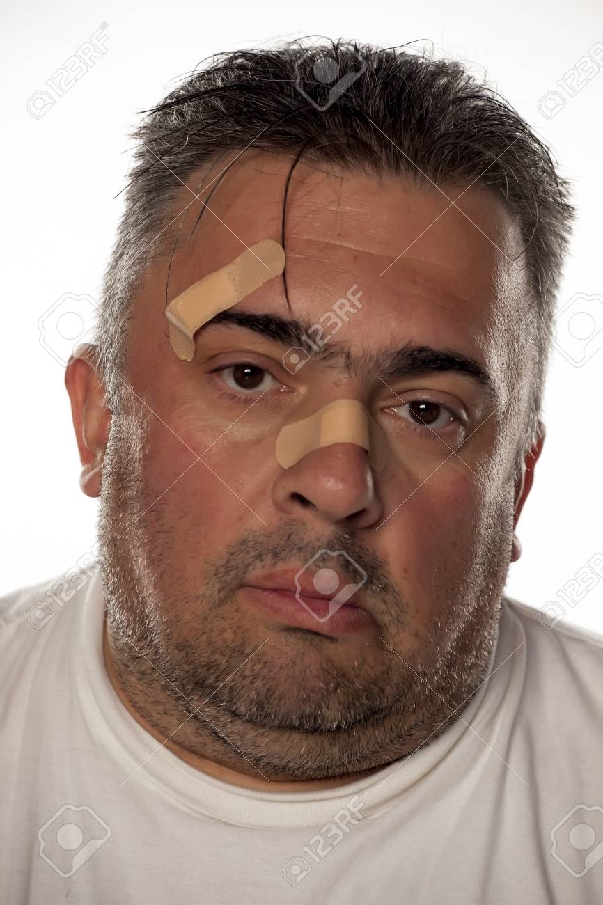 彼の鼻と眉の上のパッチとデブ男 の写真素材 画像素材 Image 彼の鼻と眉の上のパッチとデブ男 の写真素材 画像素材 Image