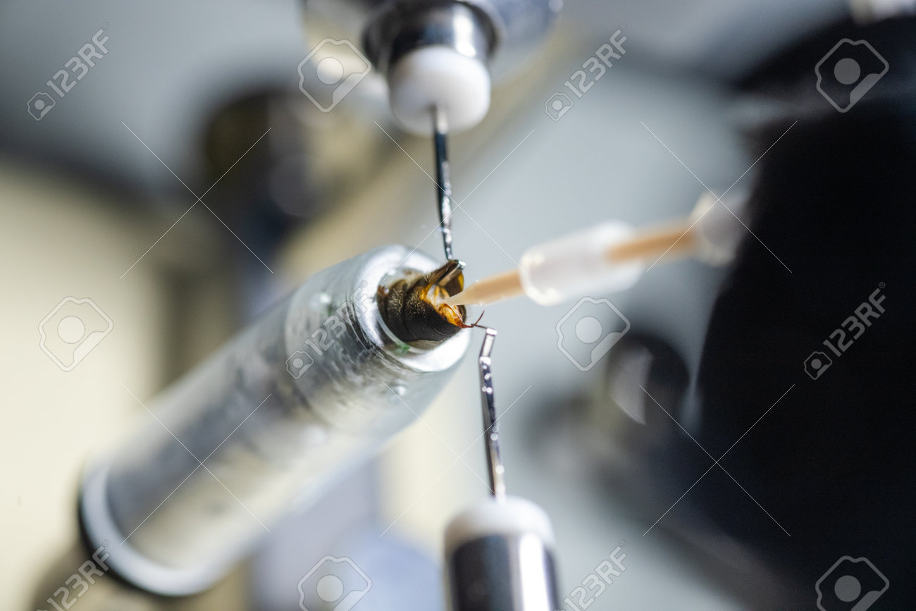 子宮口精子注射画像