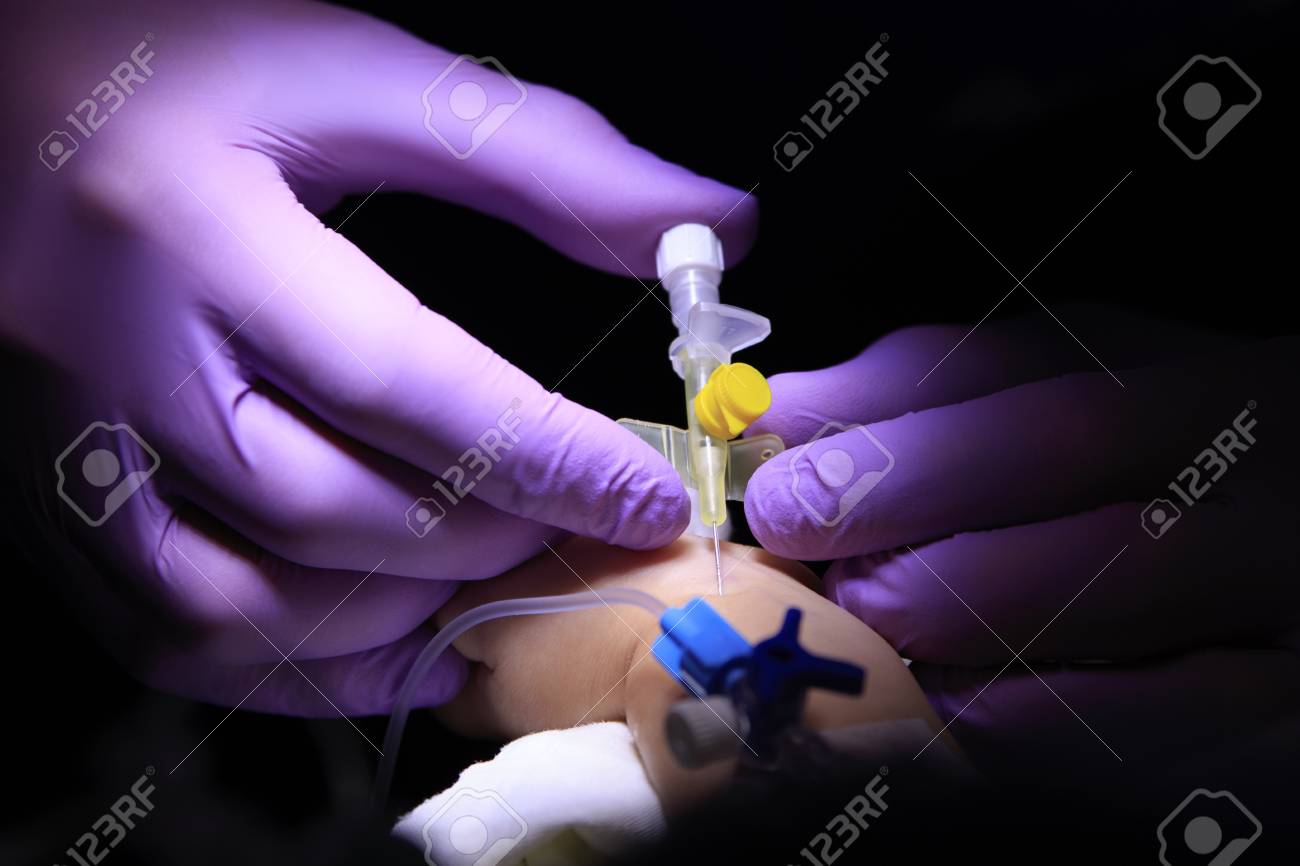 紫の手袋のクローズ アップで麻酔科医の手によって子供の腕にカテーテル インストール の写真素材 画像素材 Image