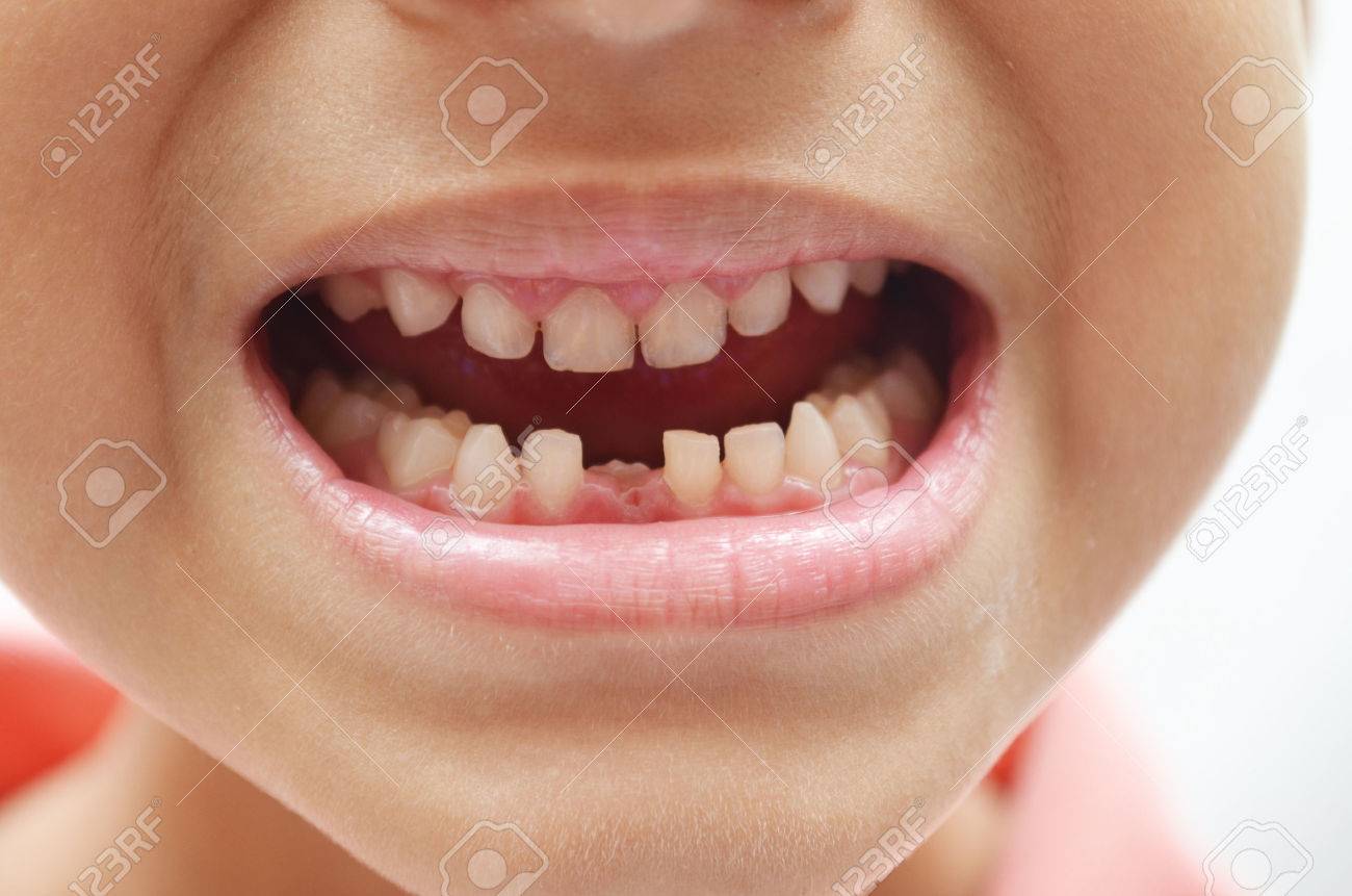 first tooth out