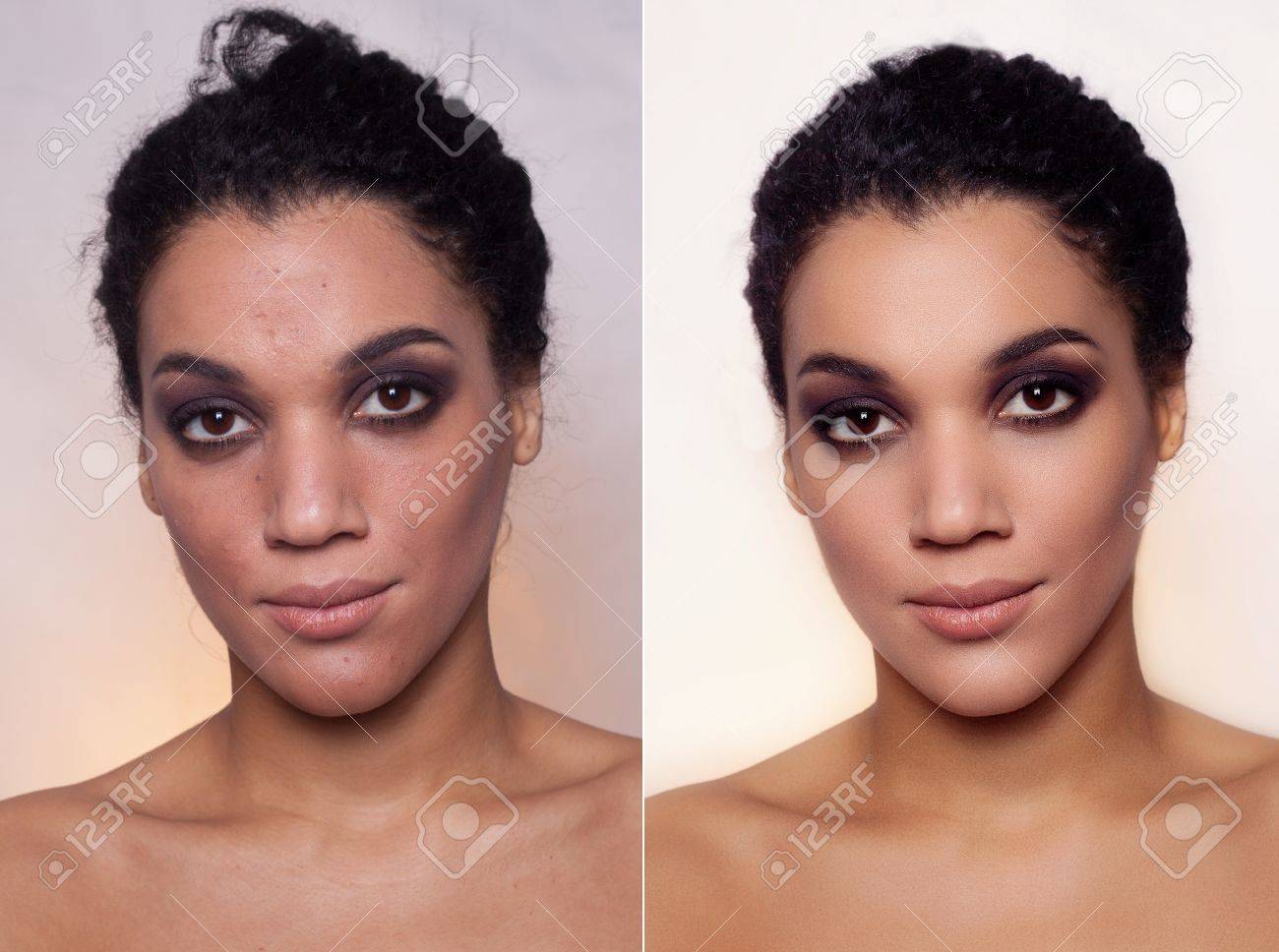 Vor Und Nach Der Kosmetischen Operation Junge Hubsche Frau Mulatte Dunkelhautigen Portrat Studio Bild Hellen Hintergrund Vor Und Nach Der Plastischen Verfahren Anti Age Therapie Untersuchend Linse Lizenzfreie Fotos Bilder Und Stock Fotografie