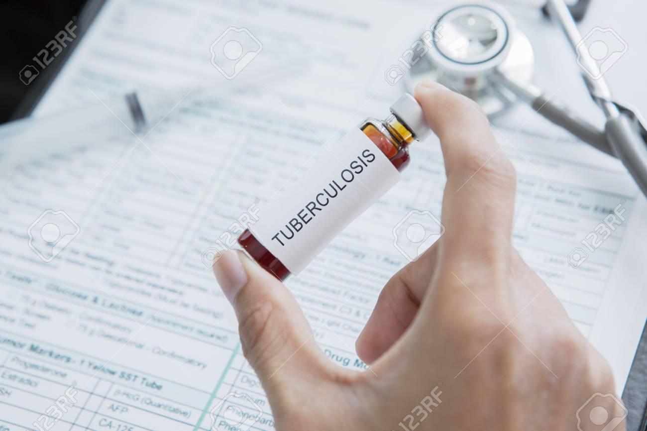 Close up of unknown female doctor showing an ampule with Tuberculosis word - 115910582 Close up of unknown female doctor showing an ampule with Tuberculosis word - 115910582