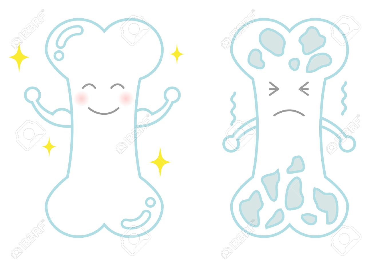 強い骨と骨粗しょう症のイラスト素材 ベクタ Image