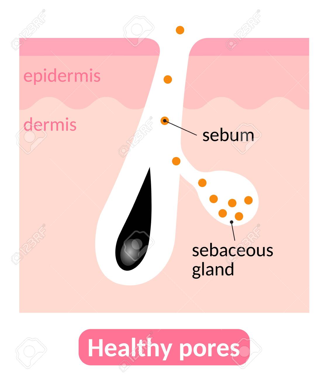 Sebaceous Glands Create Sebum That Keeps The Skin Moist And Helps Royalty Free Cliparts Vectors And Stock Illustration Image
