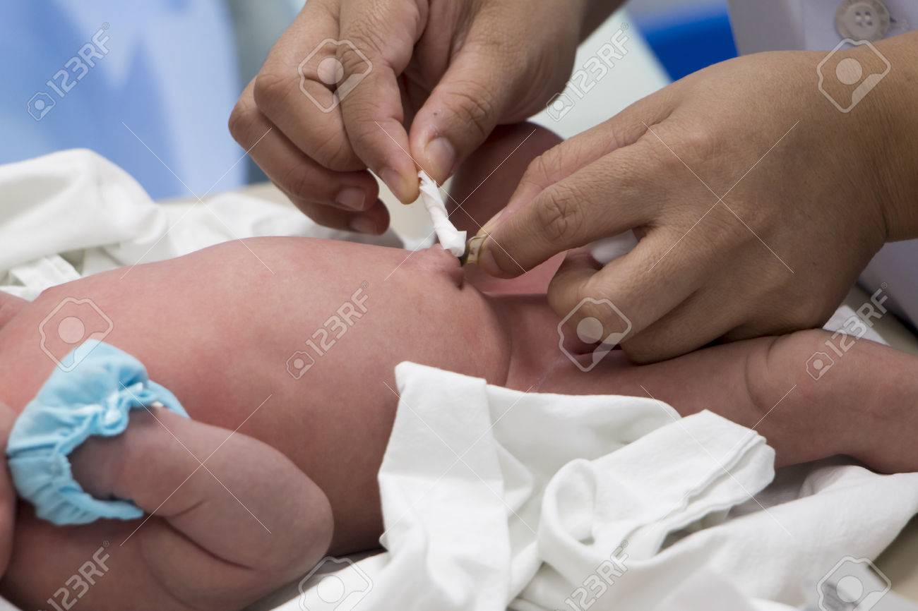 新生児のへその緒をクリーニング の写真素材 画像素材 Image 新生児のへその緒をクリーニング の写真素材 画像素材 Image