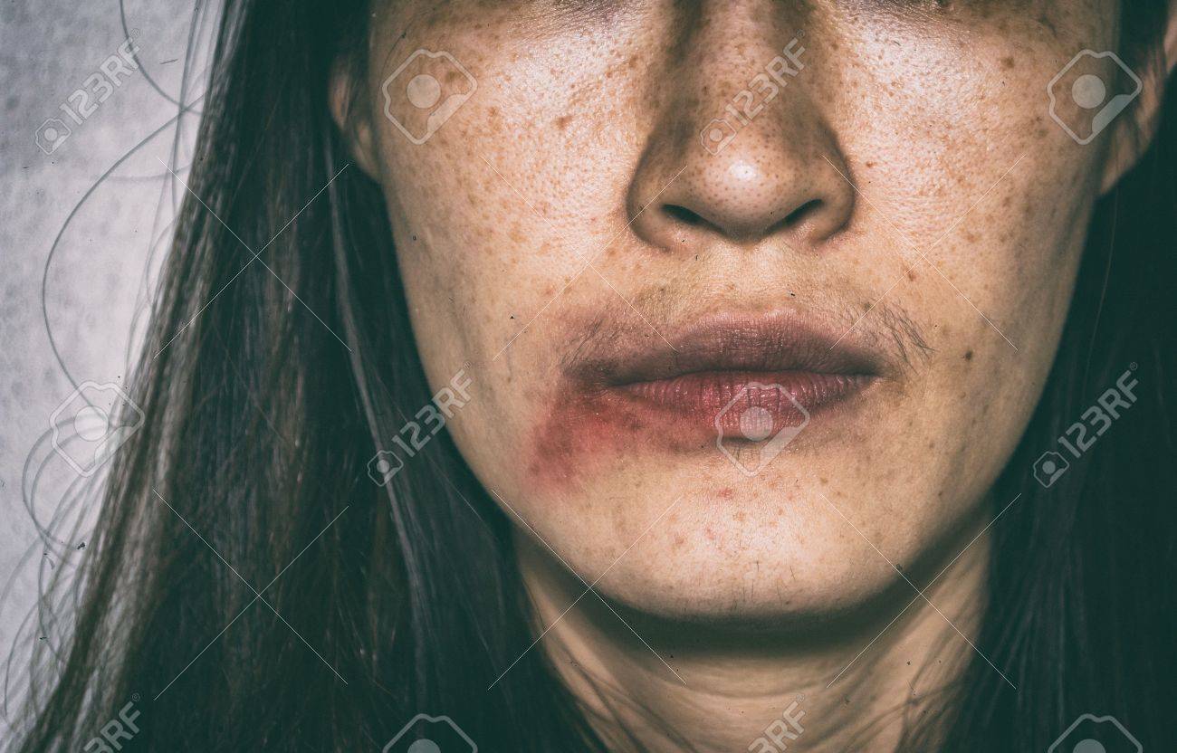 Stock Photo Woman Being Abuse Bruised On Face With Black Shadow Stock Photo Woman Being Abuse Bruised On Face With Black Shadow