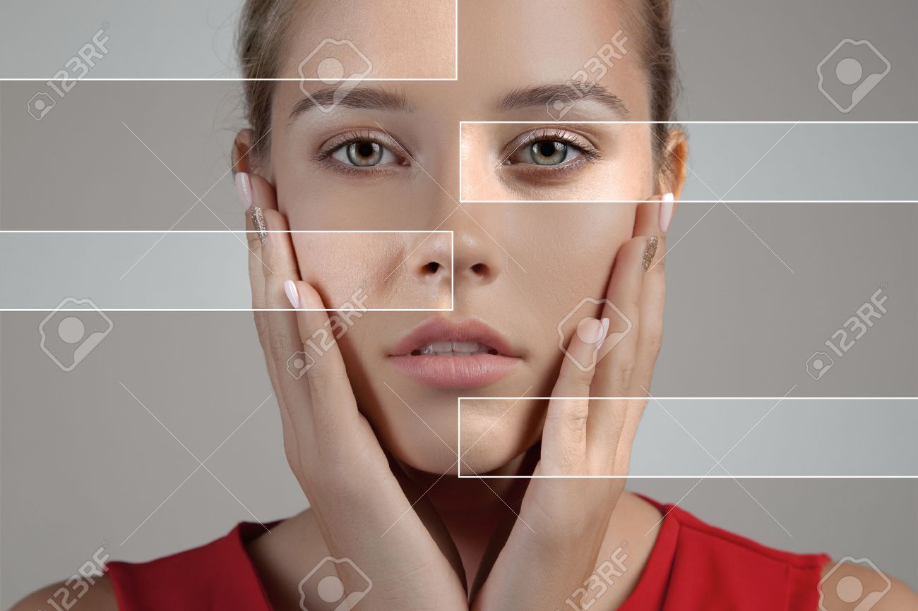 Woman with spotty skin with deep pores and blackhead and healed soft skin - 37408779 Woman with spotty skin with deep pores and blackhead and healed soft skin - 37408779