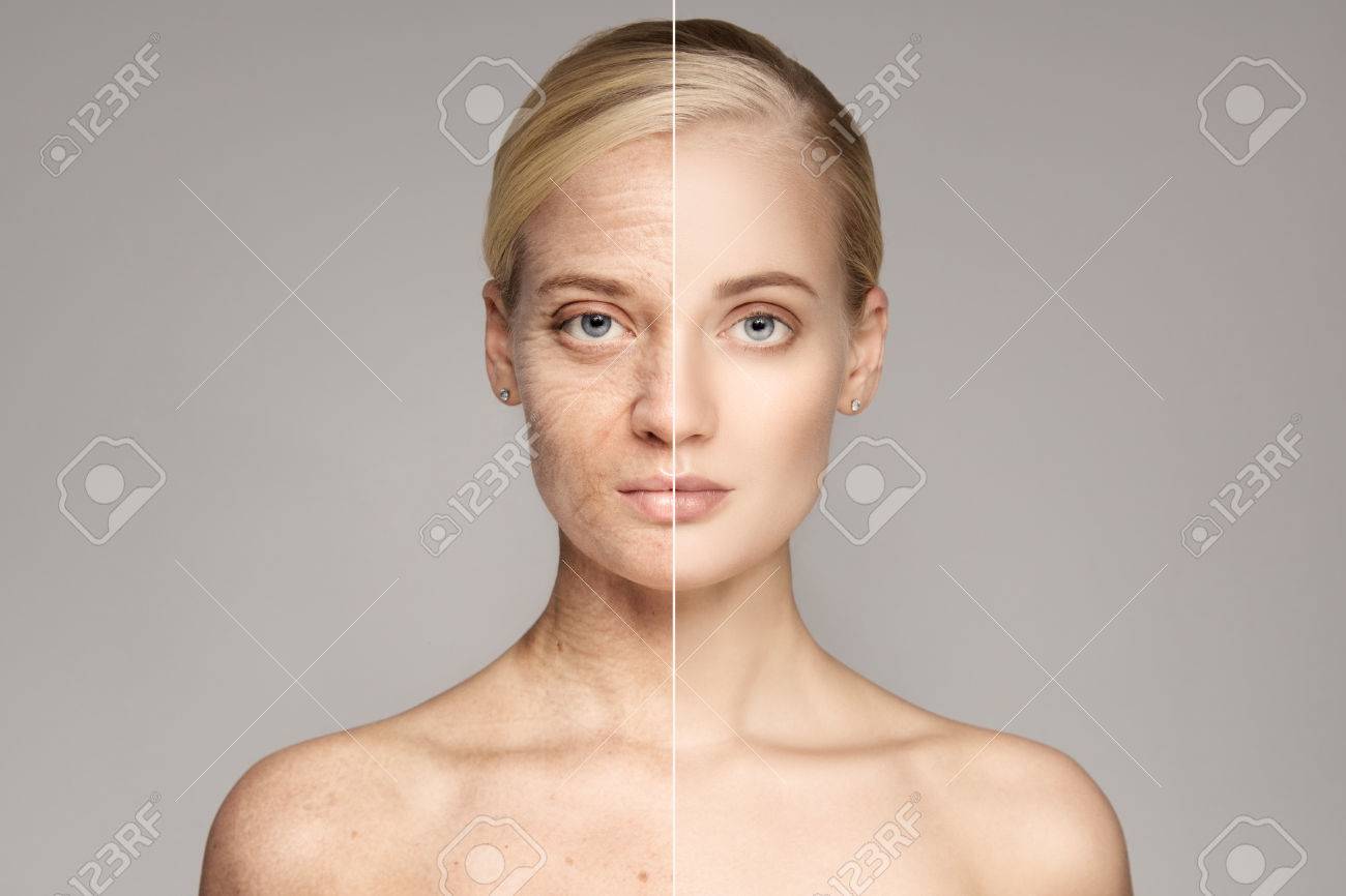 Portrait Of Beautiful Young Blond Woman With Perfect Skin. - 79741616 Portrait Of Beautiful Young Blond Woman With Perfect Skin. - 79741616
