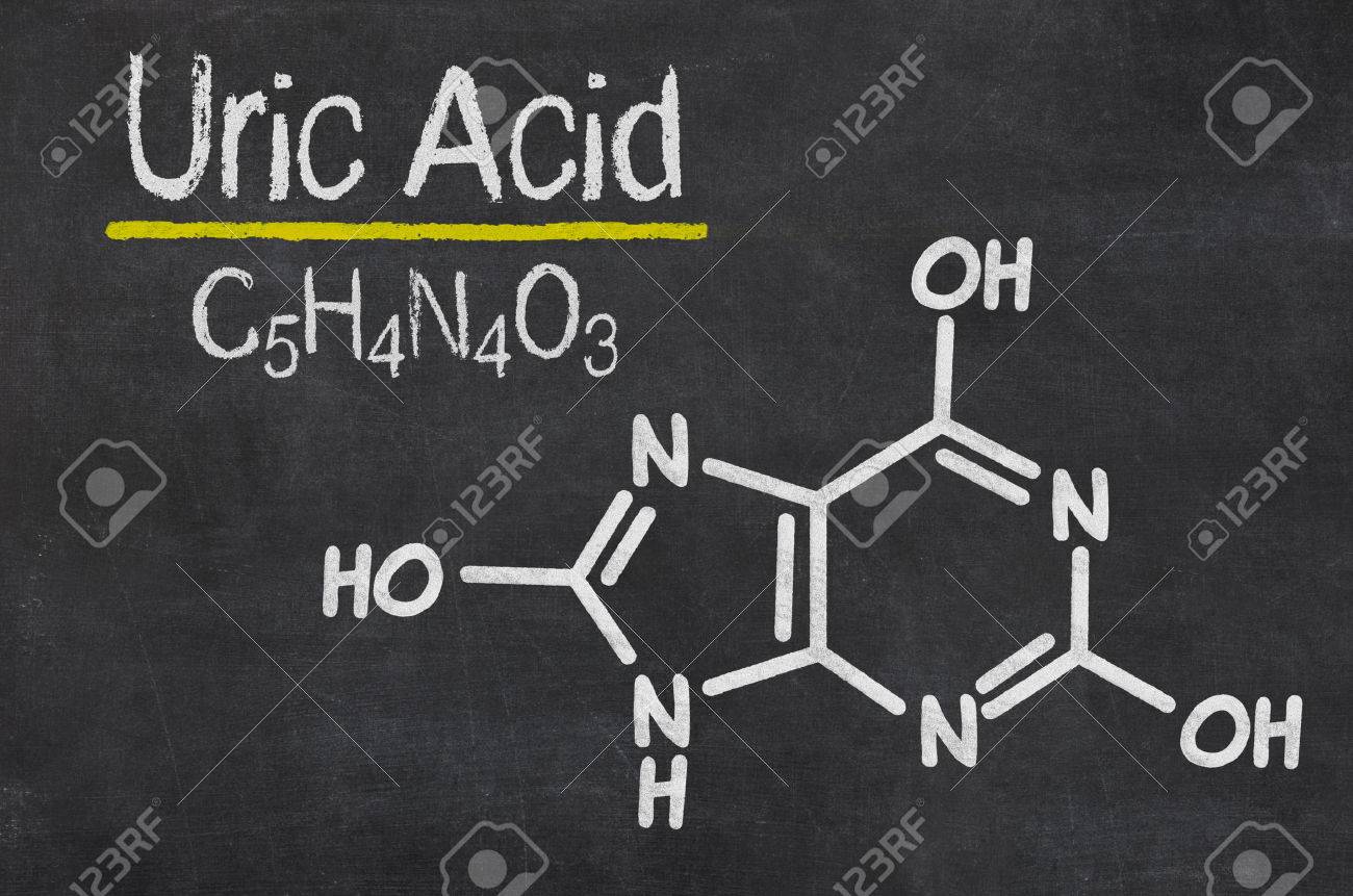 Blackboard With The Chemical Formula Of Uric Acid Stock Photo Picture And Royalty Free Image Image 33550730