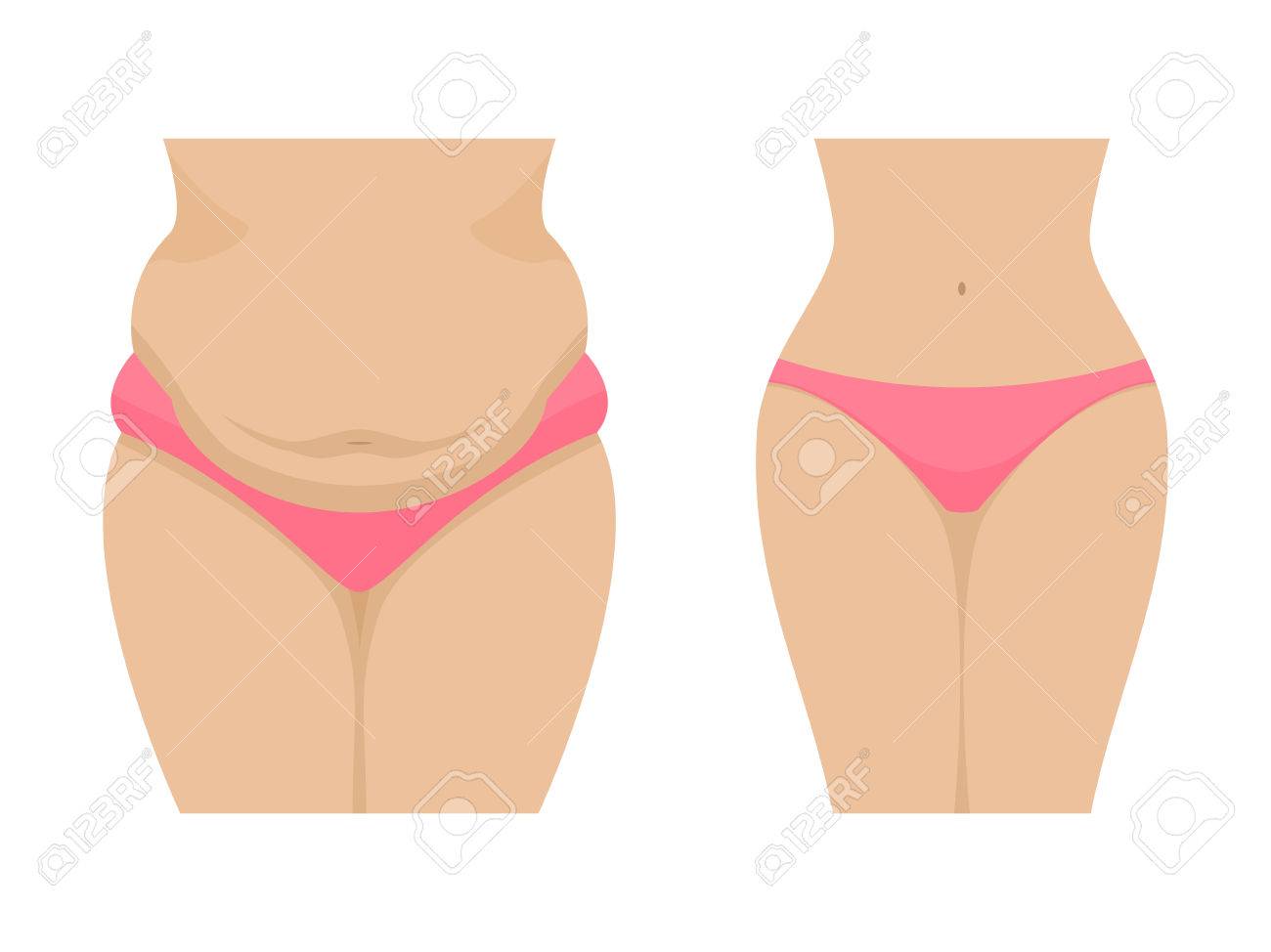 脂肪と薄い女性の腹のベクトル イラストのイラスト素材 ベクタ Image
