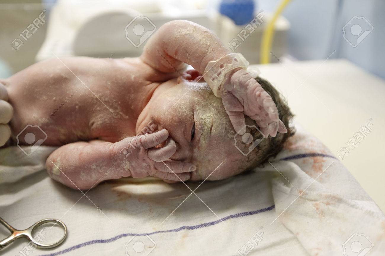 Vernix Covered Newborn With A Lot Of Hair Lying On A Table Under