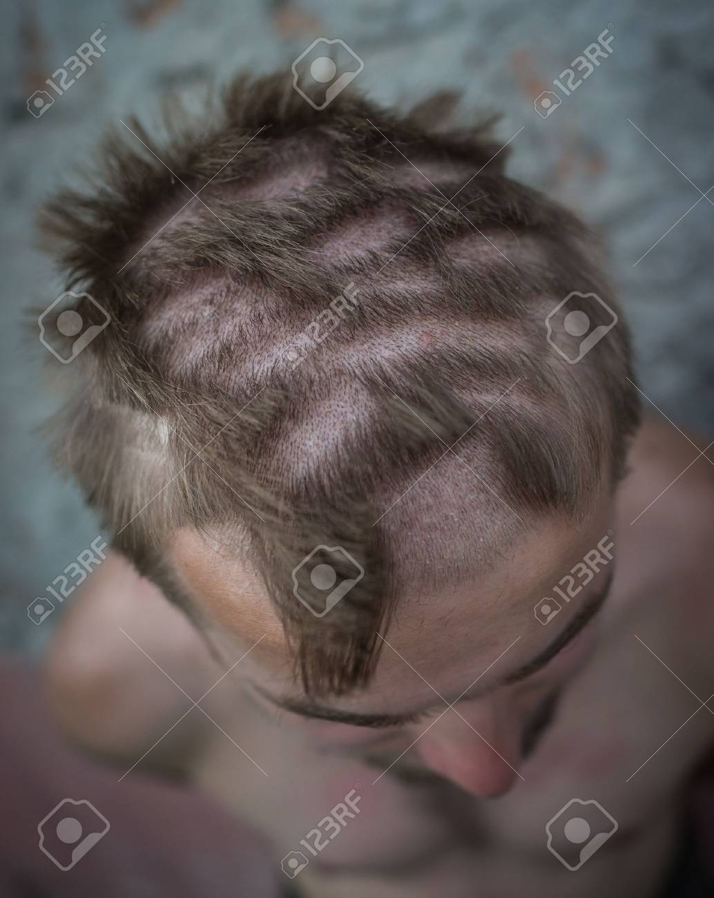 若い男は傷んだ髪をポートレート クローズ アップ の写真素材 画像素材 Image